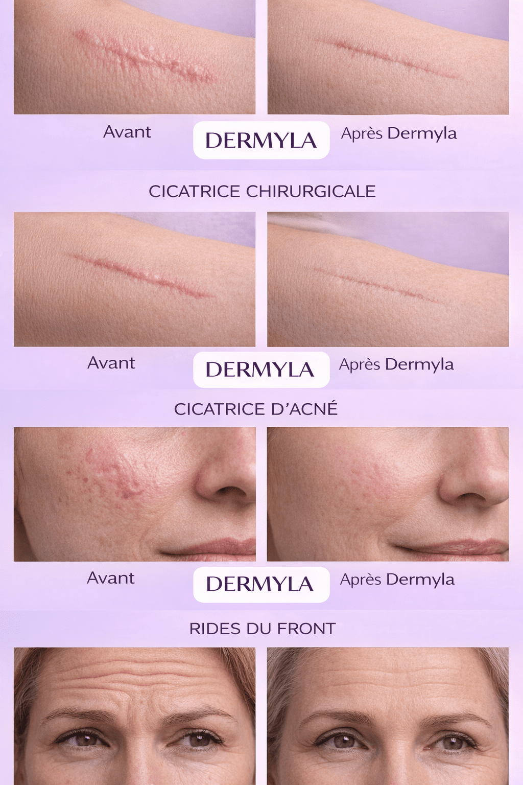 Dermyla - Feuilles de collagène en silicone – Hydratation luxueuse pour une peau radieuse - Ma boutique