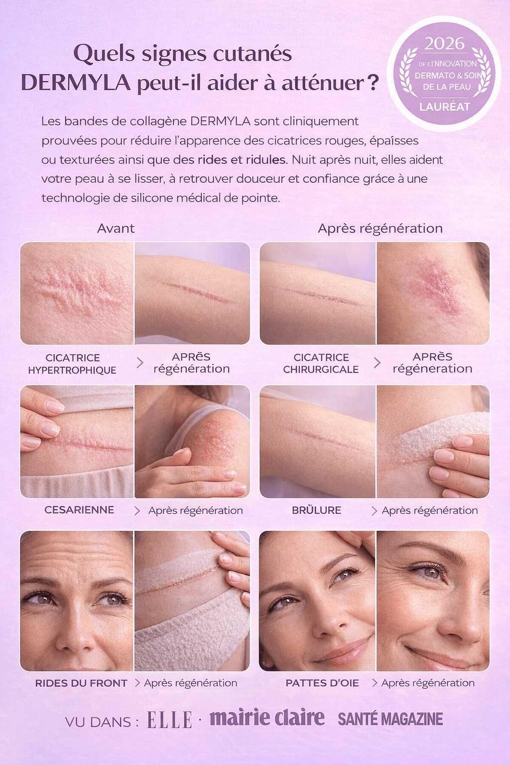 Dermyla - Feuilles de collagène en silicone – Hydratation luxueuse pour une peau radieuse - Ma boutique