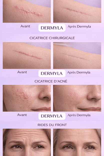 Dermyla - Feuilles de collagène en silicone – Hydratation luxueuse pour une peau radieuse - Ma boutique